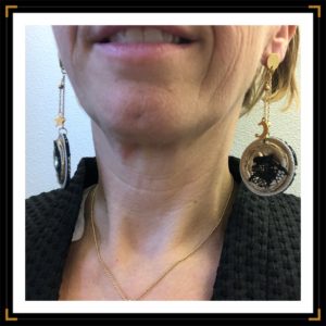 Zinsoumises acierinox dentelle